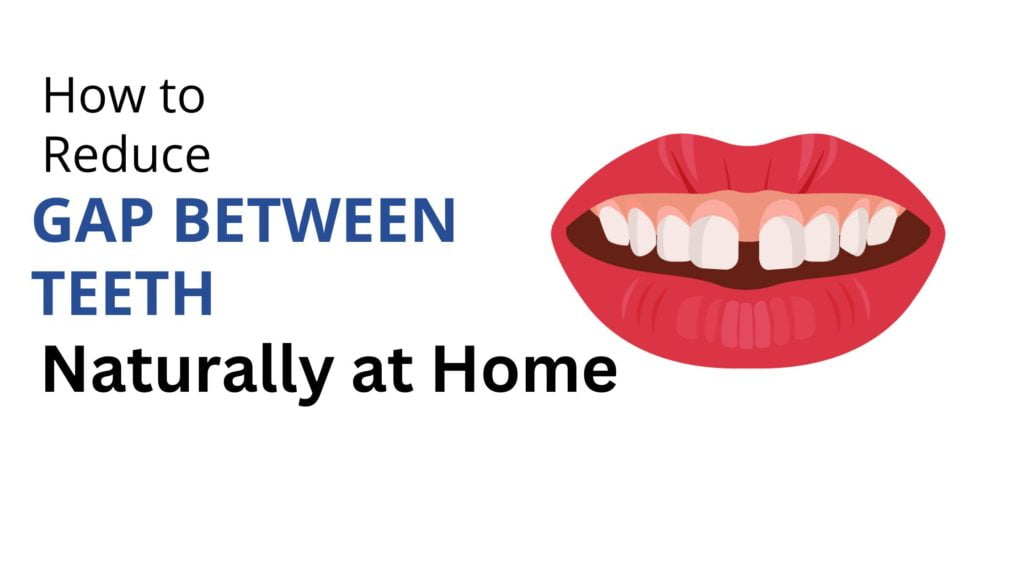 how-to-reduce-gap-between-teeth-naturally-at-home