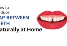How to Reduce Gap Between Teeth Naturally at Home How to Reduce Gap Between Teeth Naturally at Home