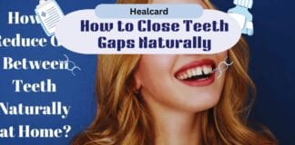 Restore Confidence By Closing The Gaps Between Teeth With Simple Restore Confidence By Closing The Gaps Between Teeth With Simple