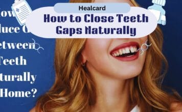 Restore Confidence By Closing The Gaps Between Teeth With Simple Restore Confidence By Closing The Gaps Between Teeth With Simple
