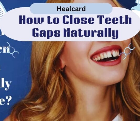 Restore Confidence By Closing The Gaps Between Teeth With Simple Restore Confidence By Closing The Gaps Between Teeth With Simple