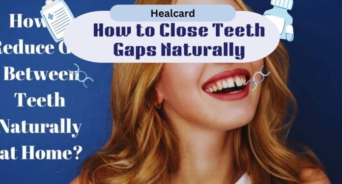 Restore Confidence By Closing The Gaps Between Teeth With Simple