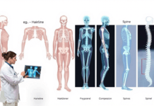 Check Out the Various Type of the Bone Fracture Different Types Of Bone Fracture From The Below Words